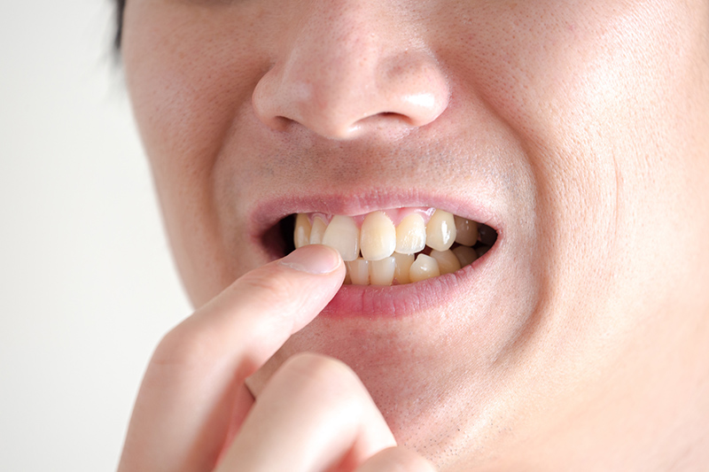 歯石除去・クリーニング後にこんな症状はございませんか？