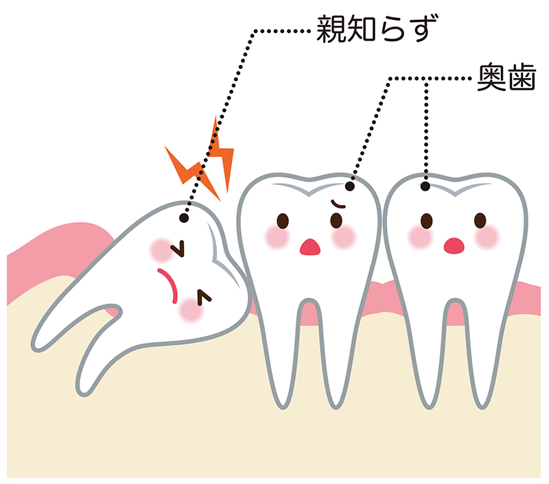 発熱 親知らず 親知らずを抜歯後、３９度を超える発熱が２日ほど続いている