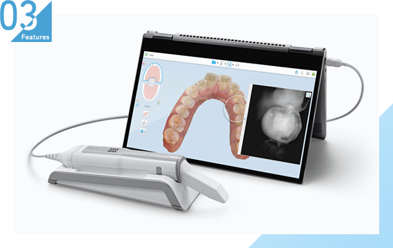 iTero element 5D(口腔内スキャナー)より 歯型の採取が負担なく精密に可能